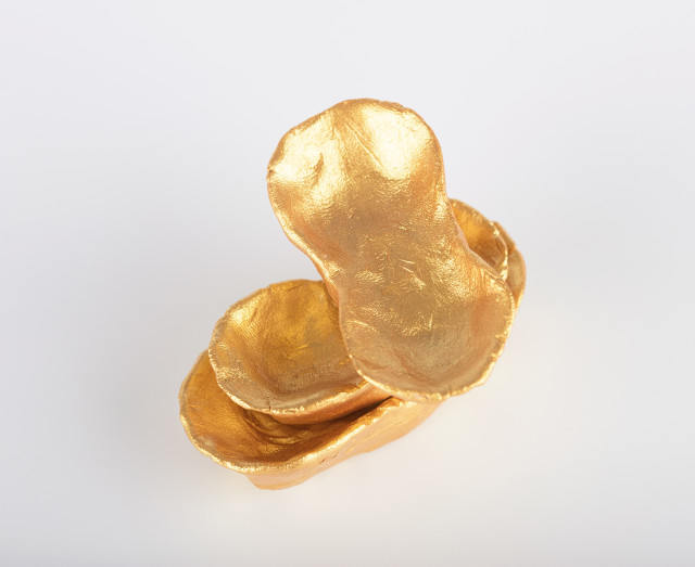 黄金投资者应关注的市场变化与趋势有哪些？